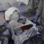 A tragic road accident at Shikaruganji Junction injured a 10-year-old boy whose arm was severed. The boy was rushed to the hospital for treatment.