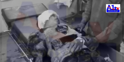 A tragic road accident at Shikaruganji Junction injured a 10-year-old boy whose arm was severed. The boy was rushed to the hospital for treatment.