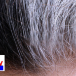 White hair at an early age is a growing concern. Genetics, stress, poor nutrition, and other factors contribute to premature graying. Experts explain the causes.