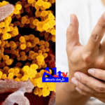 Guillain-Barré Syndrome symptoms, treatment, and risks are on the rise. Contaminated food is a key cause of the disease.