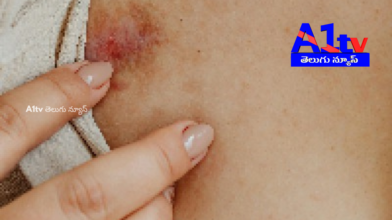 High cholesterol can cause skin changes. Identifying these early signs can help prevent severe health issues.