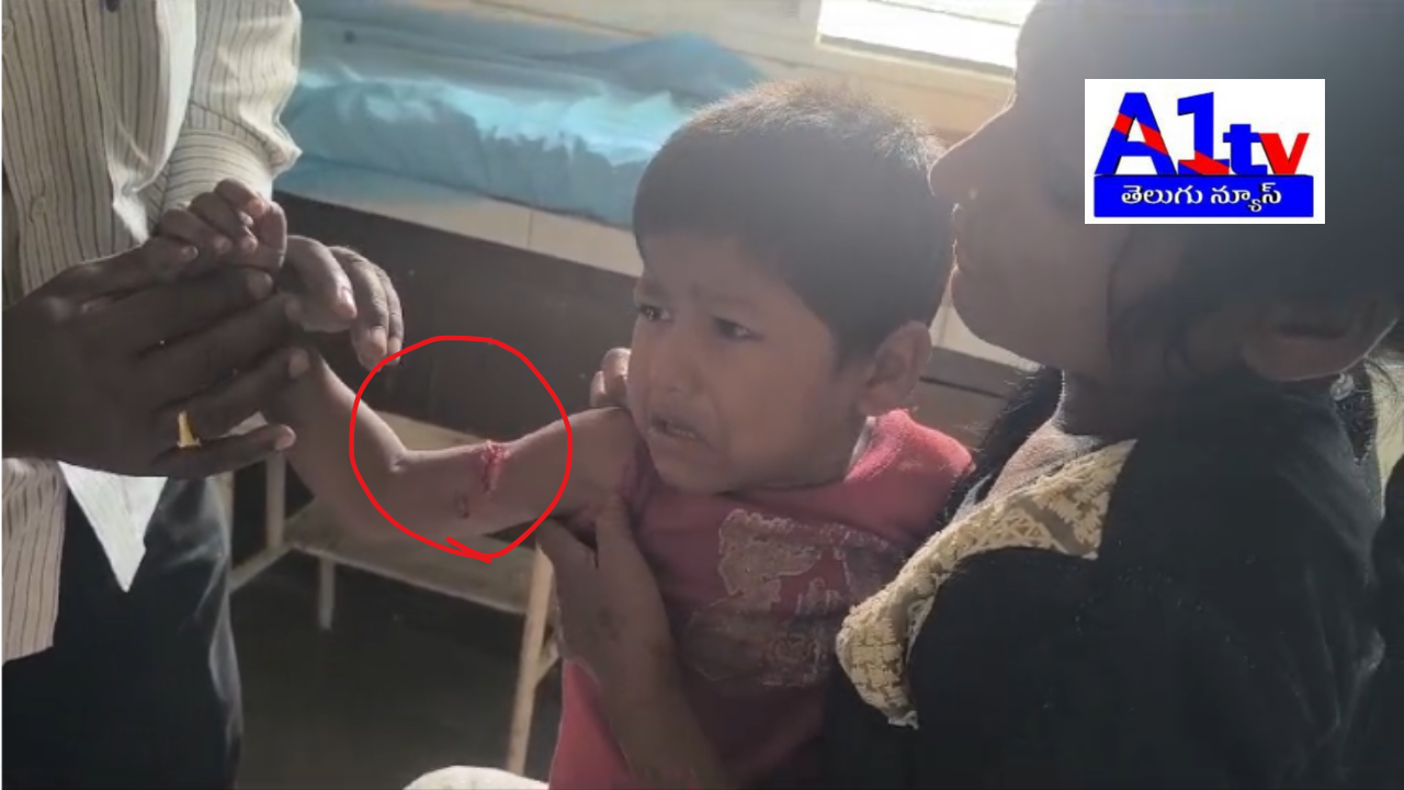 In Medak district, a three-year-old child was attacked by a dog. After initial treatment, the child was transferred to Medak Area Hospital for advanced care. Locals urge authorities to control stray dog menace.