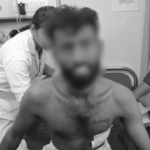 Father attacks daughter with a knife over love marriage. Injured couple hospitalized, police investigating the incident.