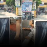 Parents allege negligence after student injured at Chandragiri Chaitanya Techno School
