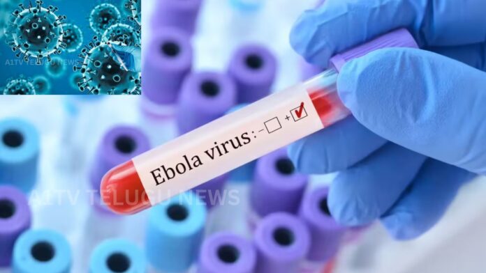 Medical officials monitoring a Ugandan woman in Bengaluru over suspected Ebola symptoms