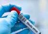Congo Ebola | ఎబోలా ఎఫెక్ట్.. కాంగోలో రోజురోజుకూ పెరుగుతున్న మరణాలు Ebola outbreak in Congo